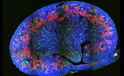 Cross section of a cystic kidney - Maria Rondon Galeano, UQ IMB